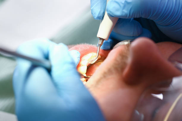 Best Emergency Broken Tooth Repair in Darrington, WA