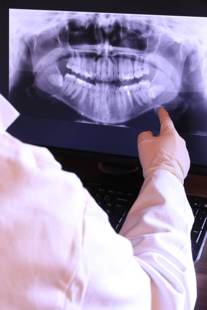 Best Emergency Wisdom Teeth Removal in Darrington, WA